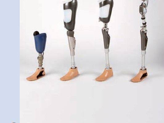 Kaki Palsu Menuju Masa Depan Disabilitas  Lebih Maju